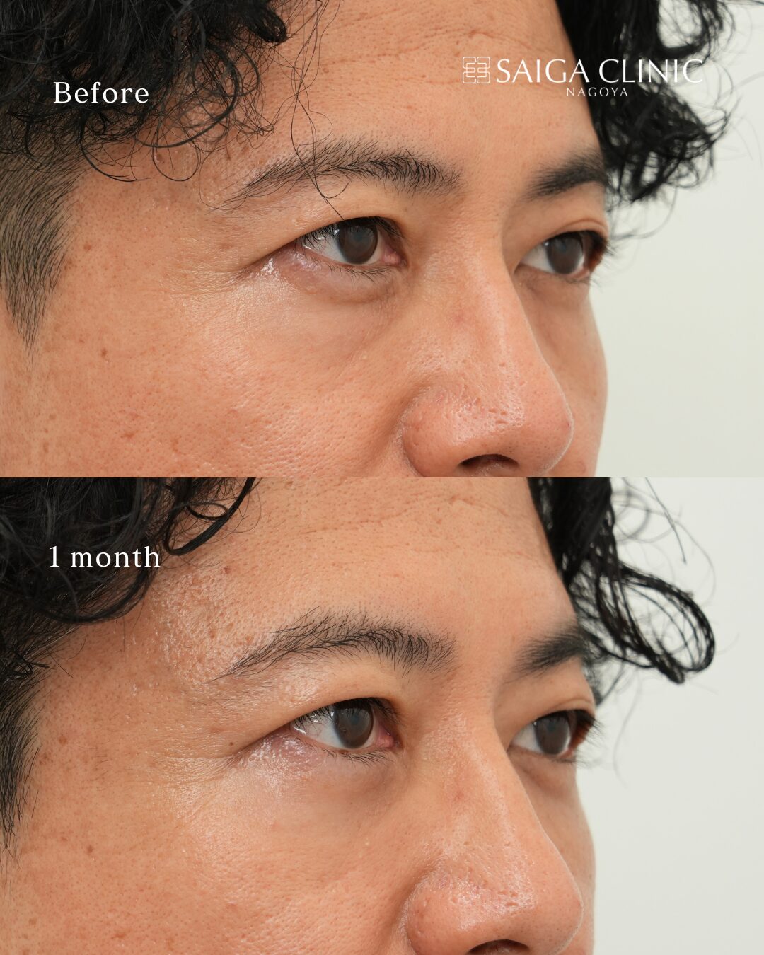 裏ハムラ の 3 枚目