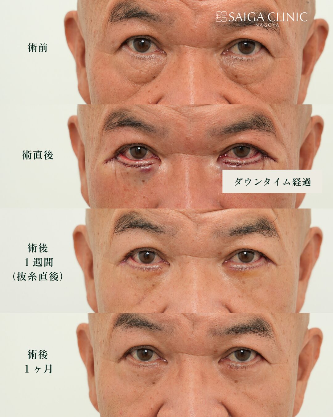 表ハムラ の 4 枚目