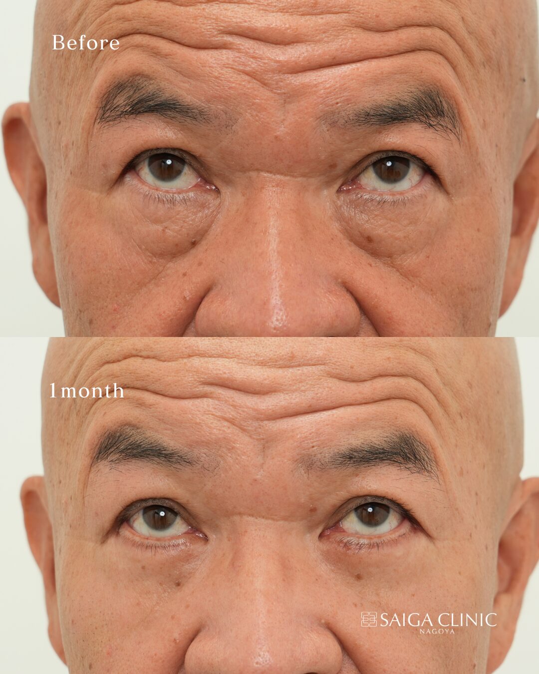 表ハムラ の 3 枚目
