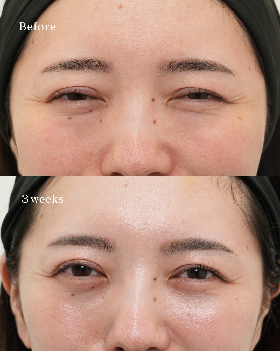 裏ハムラ の 3 枚目