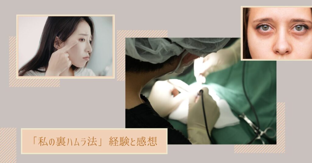 「私の裏ハムラ法」経験と感想